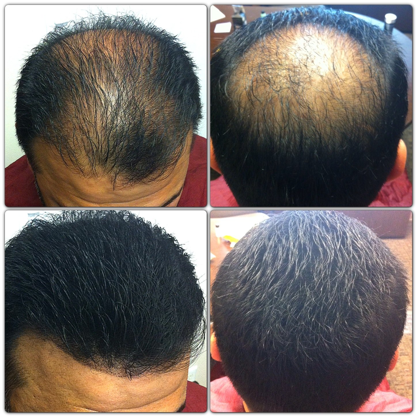 Meantime – Sistema de mejora del cabello fino (marrón oscuro)