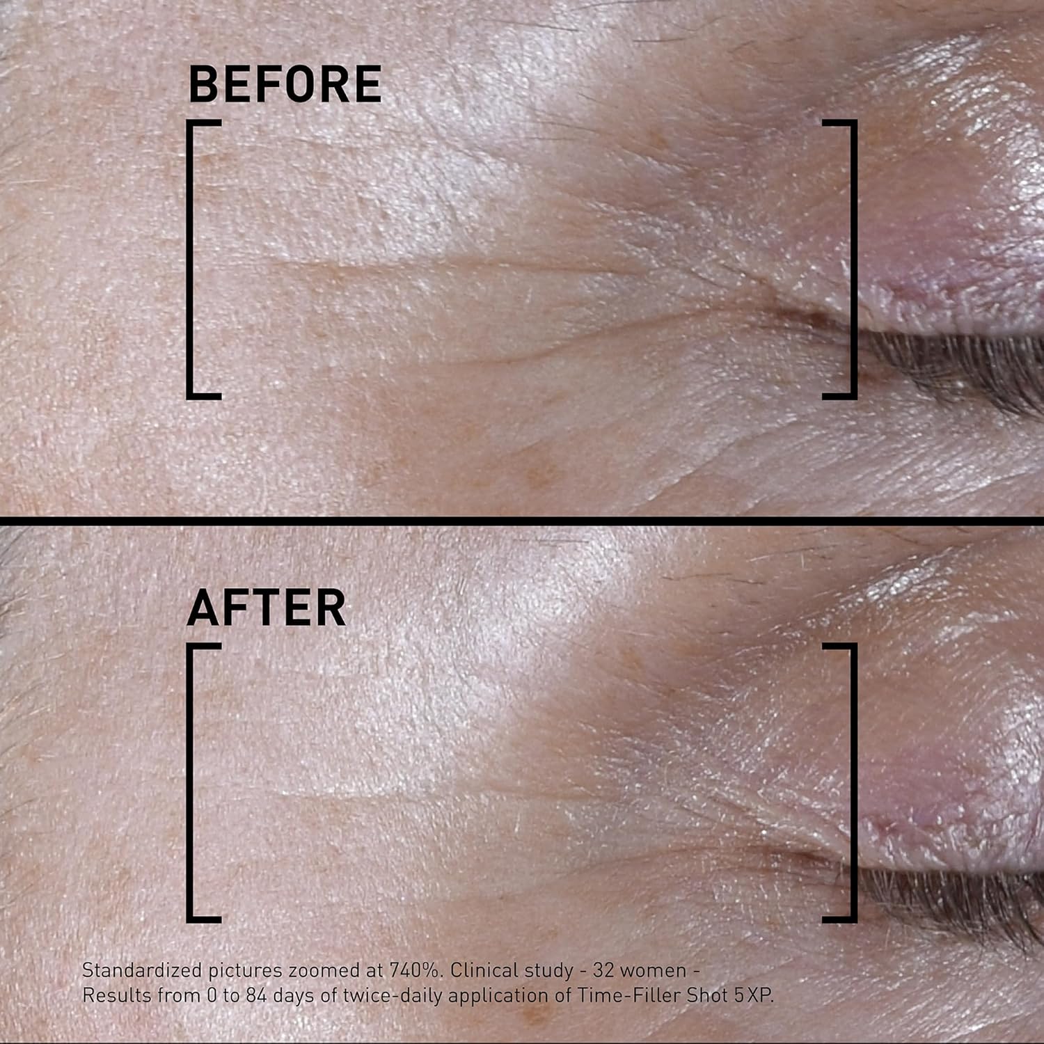 Filorga Time-Filler Shot, un suero hidratante con tecnología de neuropéptidos y polisacáridos para relajar las líneas de expresión, hidratar y