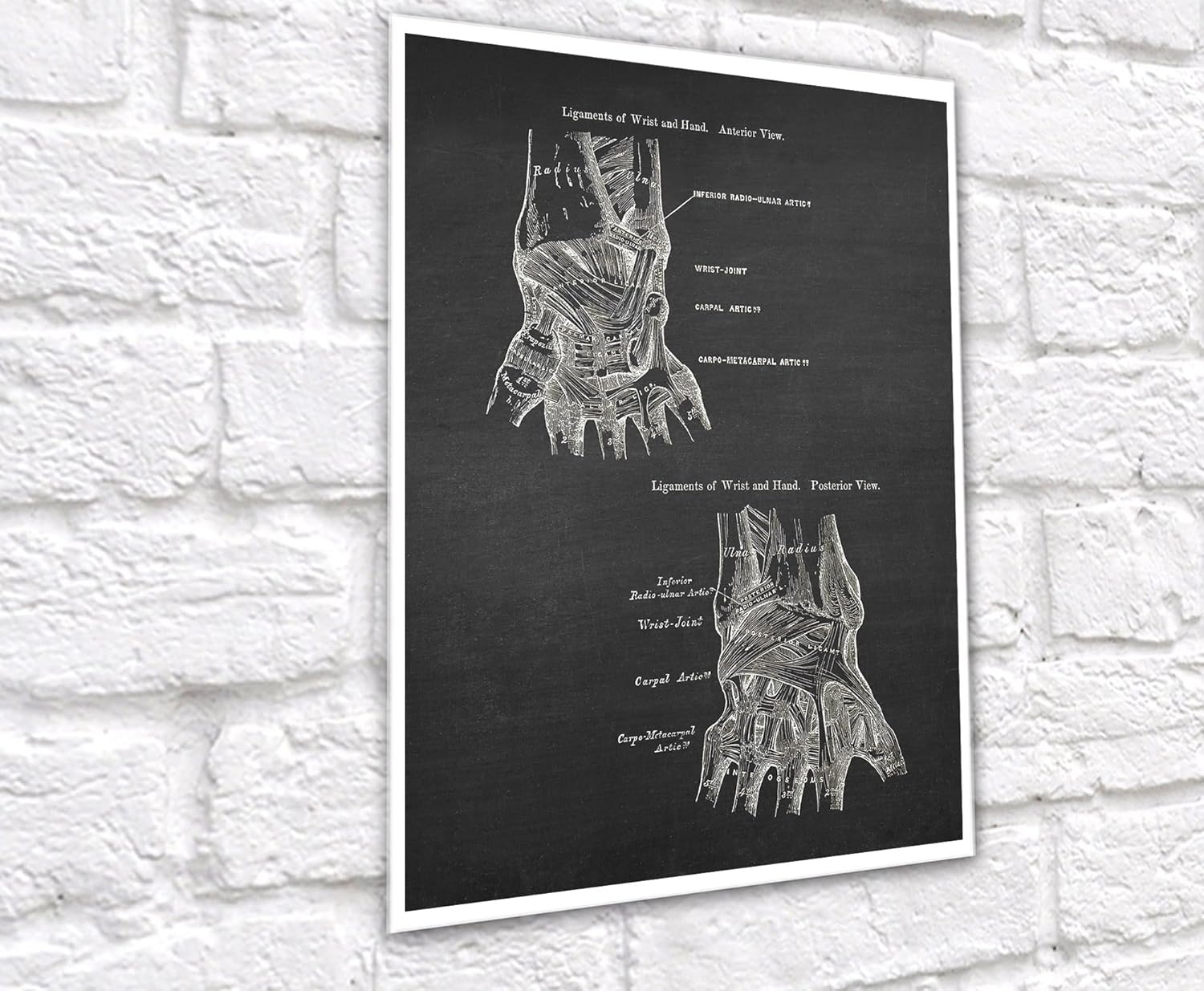Gnosis Picture Archive Anatomía de huesos de mano médica, juego de 3 impresiones artísticas sin marco, decoración ortopédica de oficina