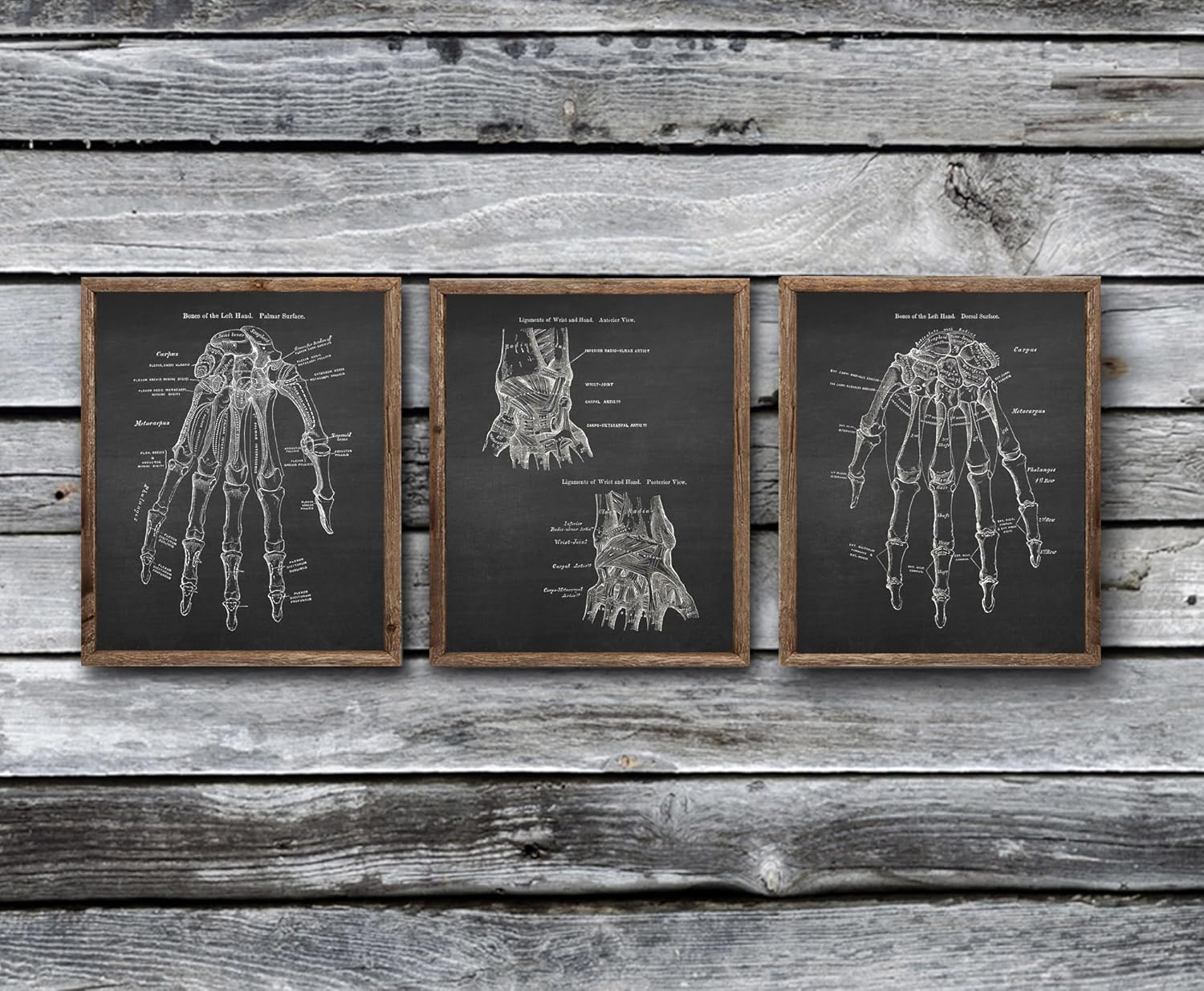 Gnosis Picture Archive Anatomía de huesos de mano médica, juego de 3 impresiones artísticas sin marco, decoración ortopédica de oficina