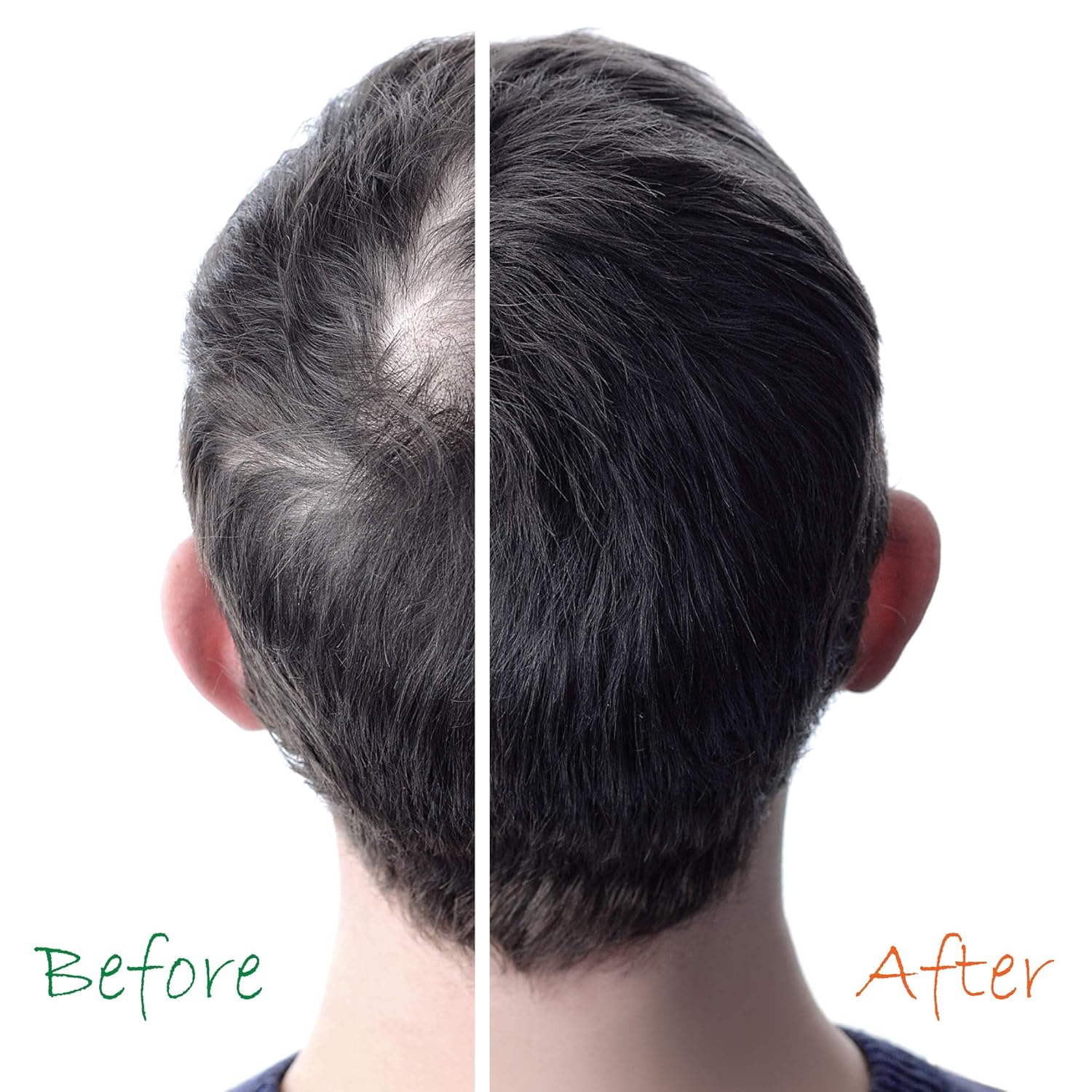 Organic Hair Energizer Pro Vitamin-B5 – Potenciador del crecimiento del cabello, 6 onzas líquidas (paquete de 4) bloqueador de DHT, sin sulfatos y