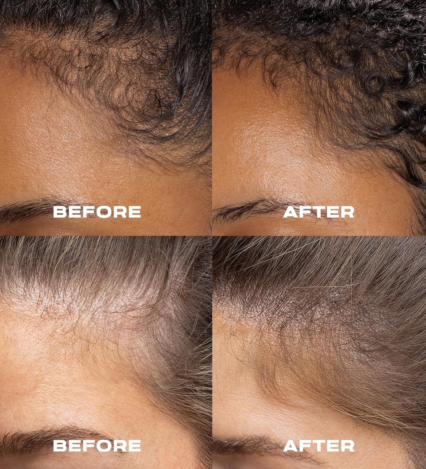XMONDO Hair A3 Complex Espuma de densidad capilar de alta intensidad  Fórmula vegana con biollagen y amaranto, activos vegetales de acción rápida