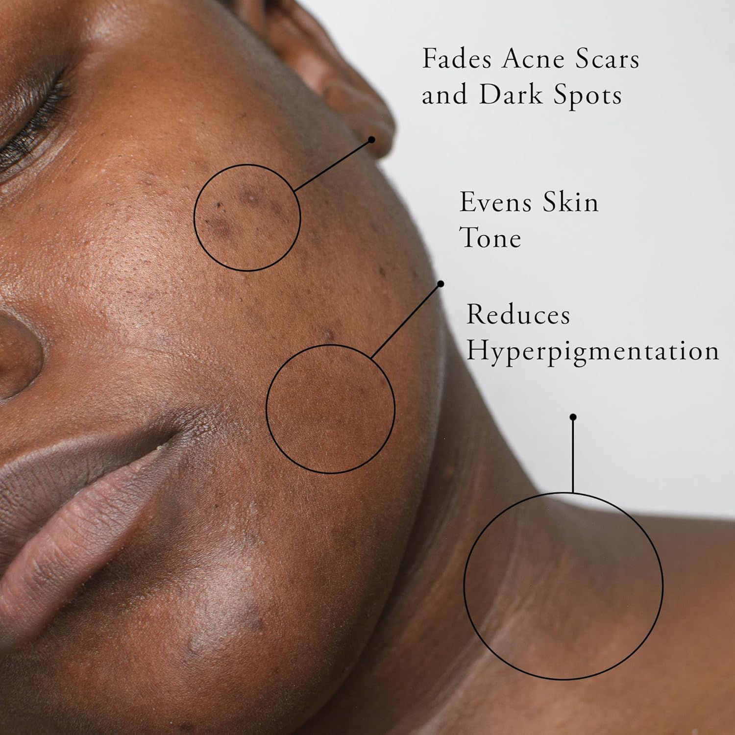 Mascarilla facial de cúrcuma con vitamina C para manchas oscuras e hiperpigmentación  Niacinamida  Probióticos