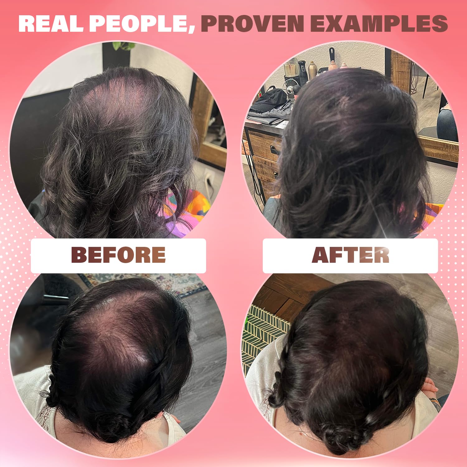 REJUVENATE Hair Fibras para adelgazar el cabello (marrón claro), polvo de cabello indetectable para mujeres y fibras 100% naturales para construir