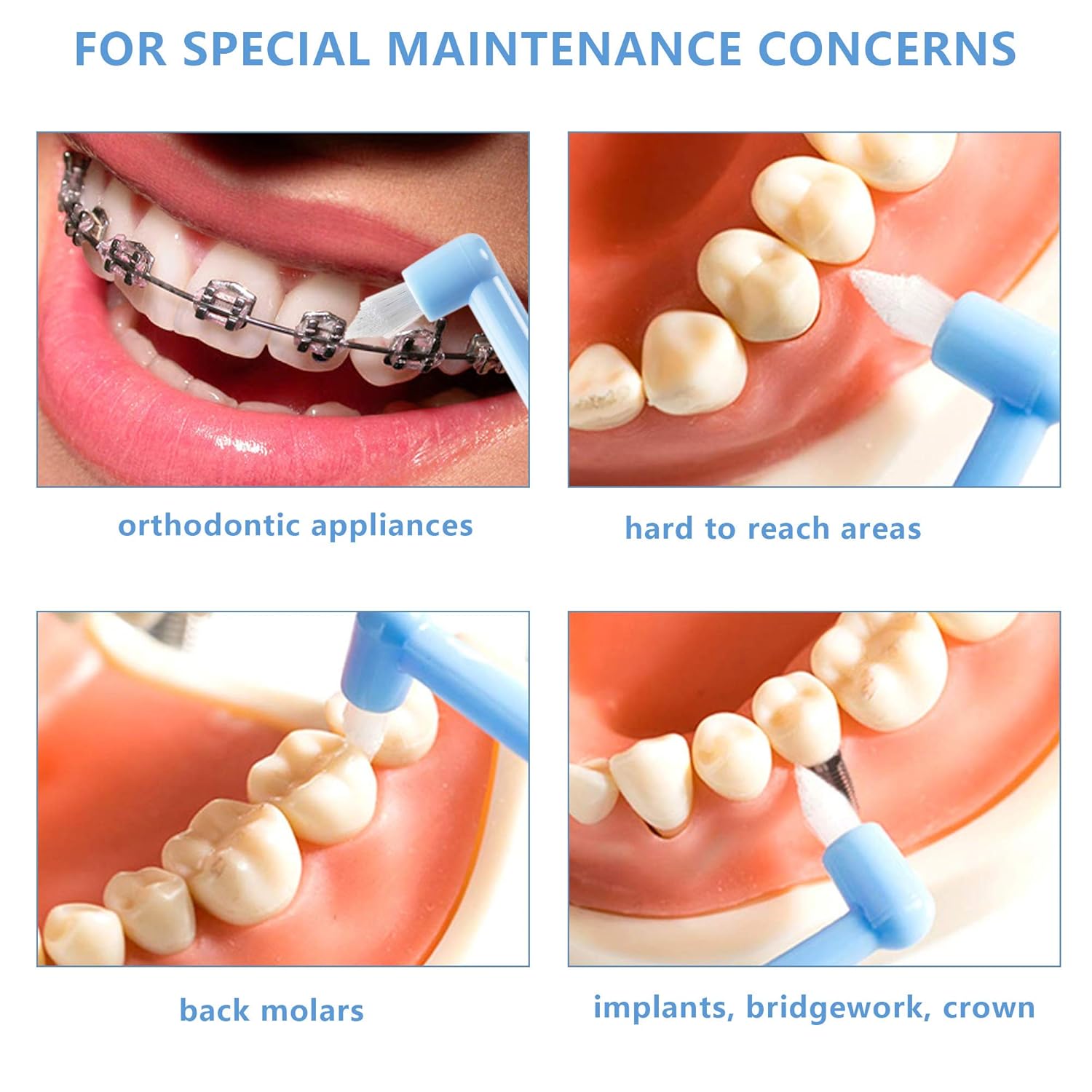 End-Tuft – Cepillo de dientes cónico, 6 piezas de cepillo de dientes copetudo, cepillo interespacial, cepillo de dientes Wisdom Gap para ortodoncia,