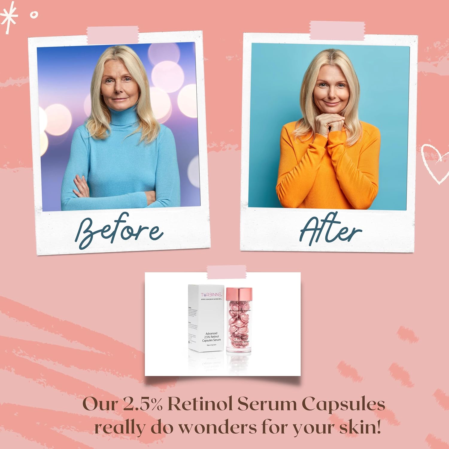 Cápsulas de suero de retinol puro al 2.5%. Luce 5 años más joven en 30 días. Potente antienvejecimiento, hidratación profunda, iluminación, reduce
