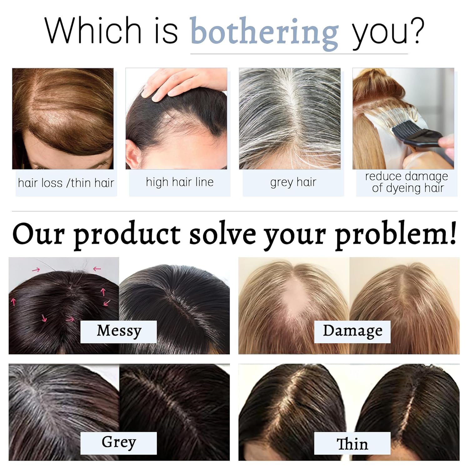 Toppers para el cabello para mujer, cabello humano real, sin flequillo, base de seda, 150% de densidad, extensiones de cabello con clip, piezas de
