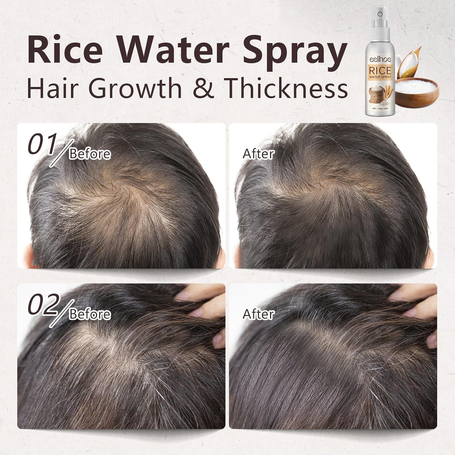 LIESE Agua de arroz para el crecimiento del cabello, suero para el crecimiento del cabello con aceite de romero para mujeres y hombres, spray de