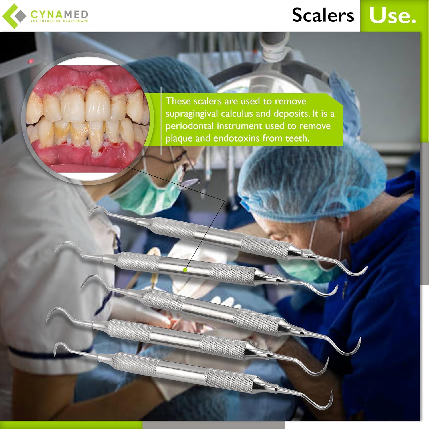 Sert of 5 Cynamed Jacquette Dental Scalers – Mango Hueco Doble Extremo Periodental Premium Instruments