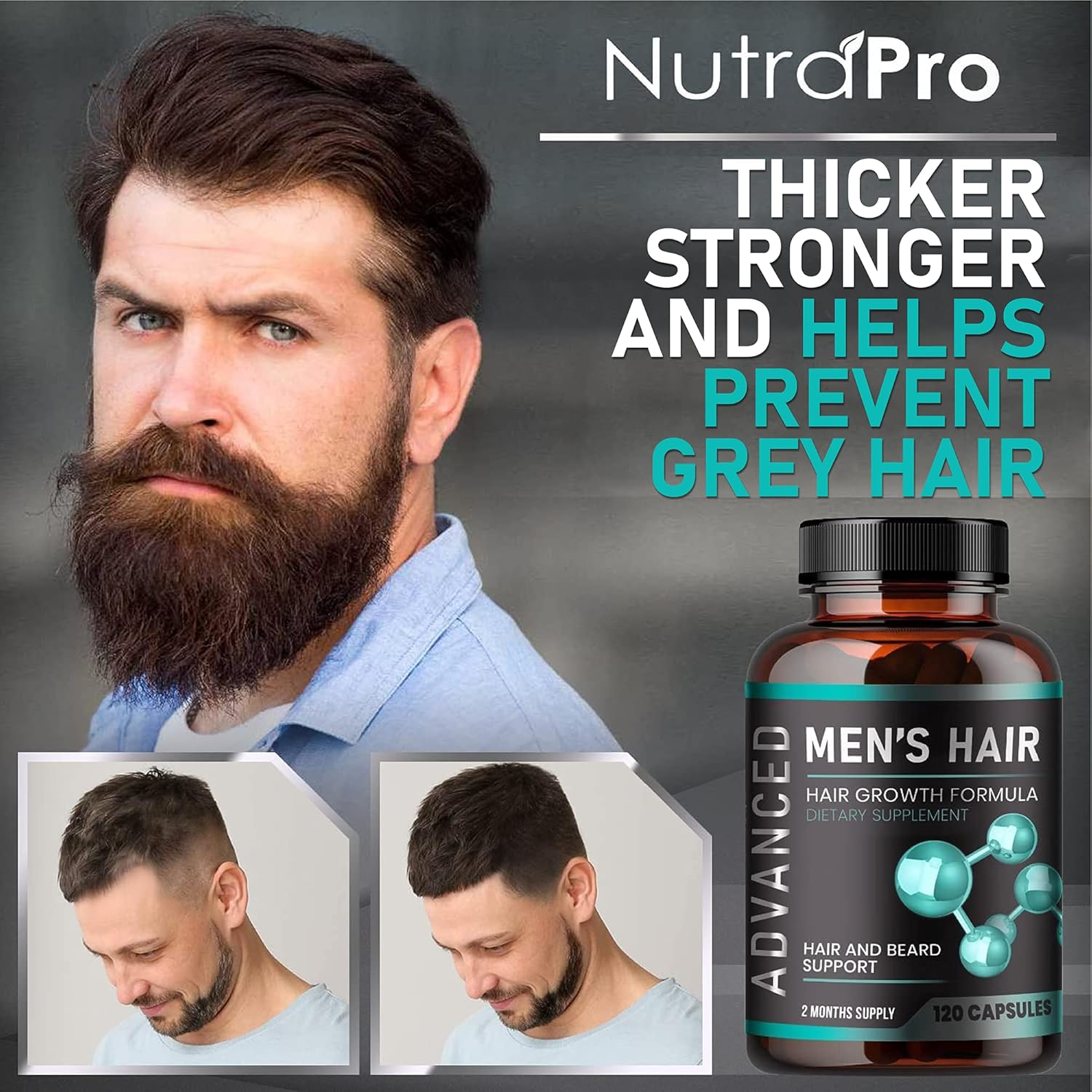 Vitaminas para el crecimiento del cabello para hombres, píldoras contra la pérdida de cabello. Suplemento para el crecimiento del cabello y el