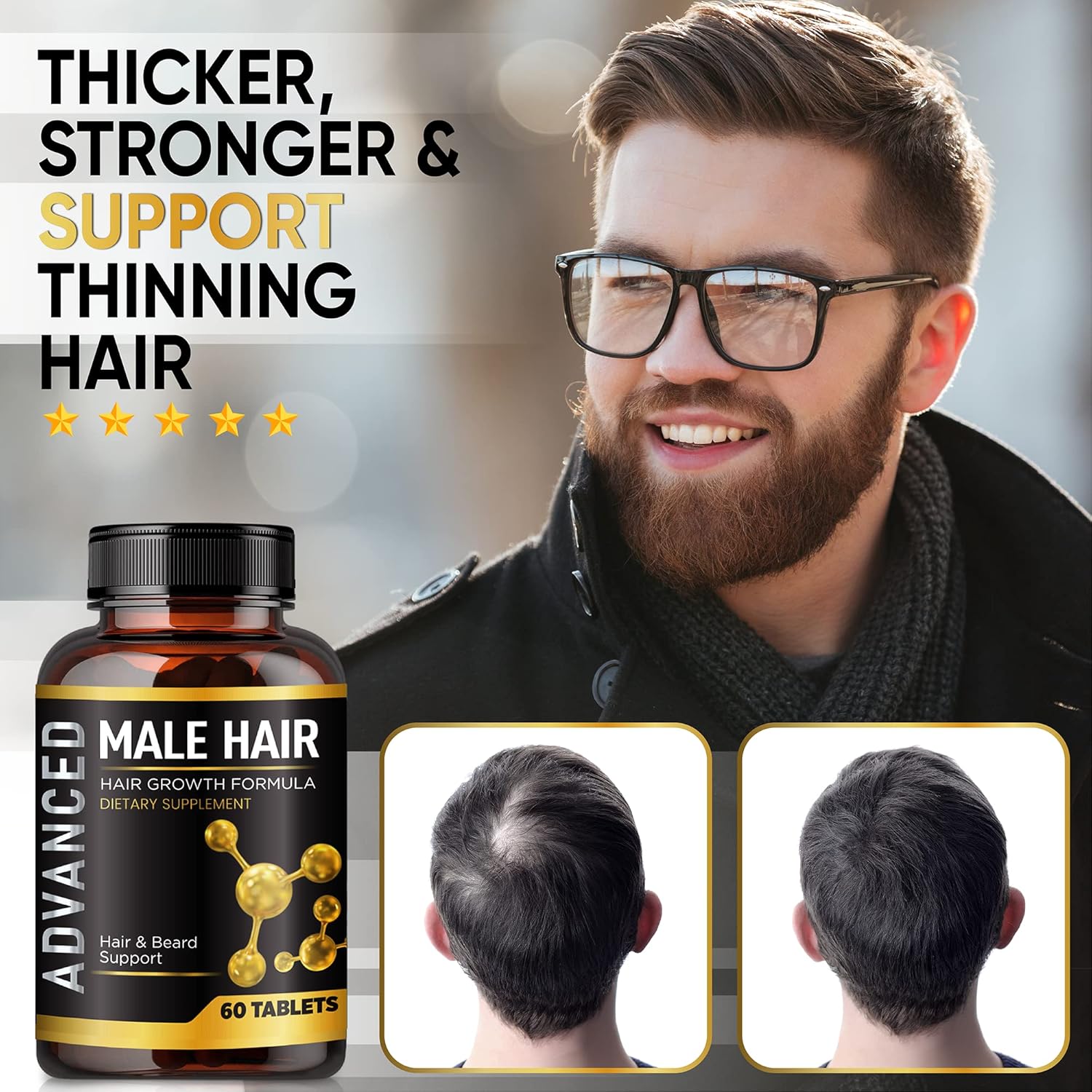 Vitaminas para el crecimiento del cabello para hombres, píldoras contra la pérdida de cabello. Suplemento para el crecimiento del cabello y el