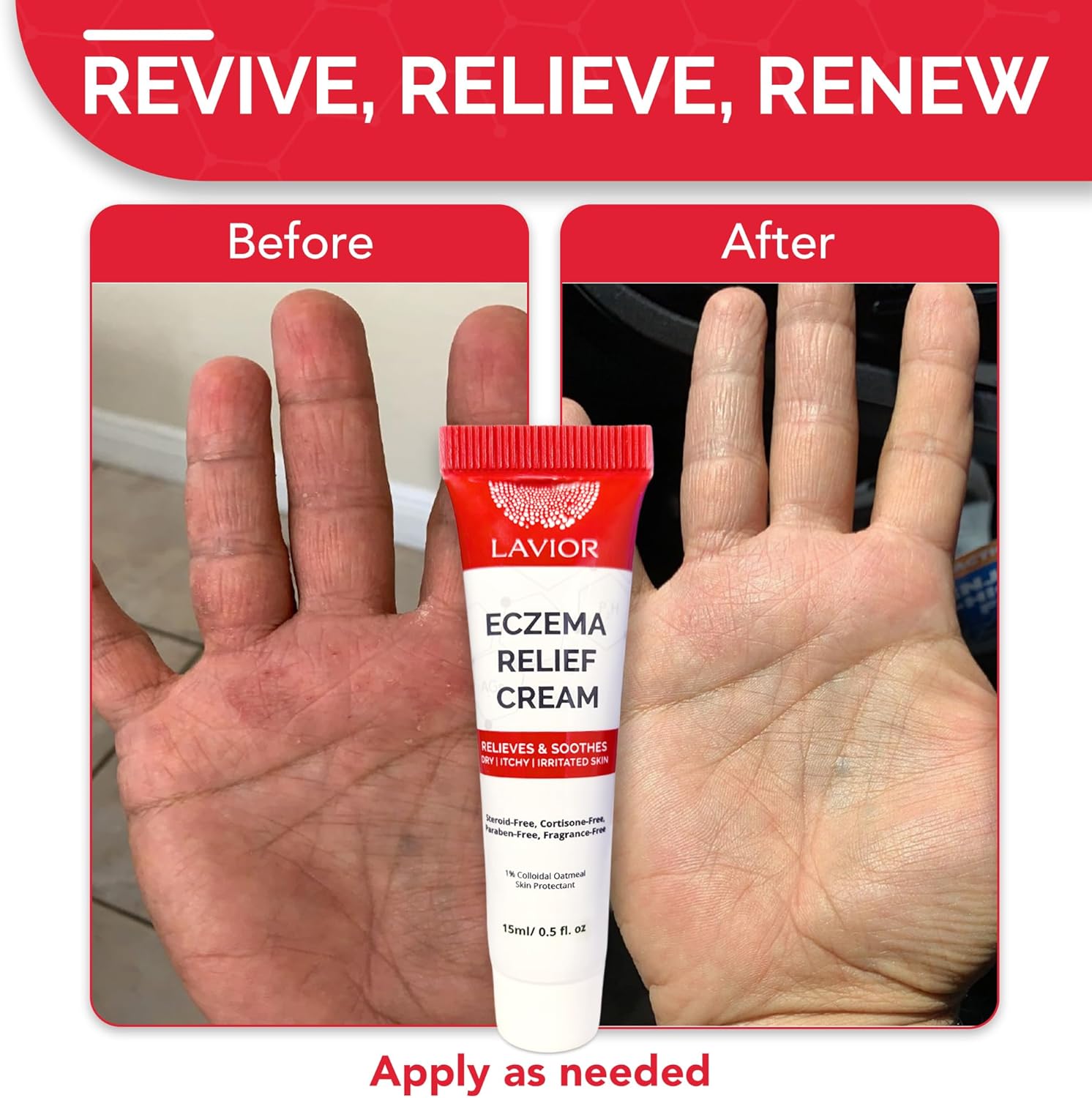 Lavior Crema para aliviar el eccema  Alivio calmante de la picazón con avena coloidal  Hipoalergénico, recomendado por médicos, clínicamente probado