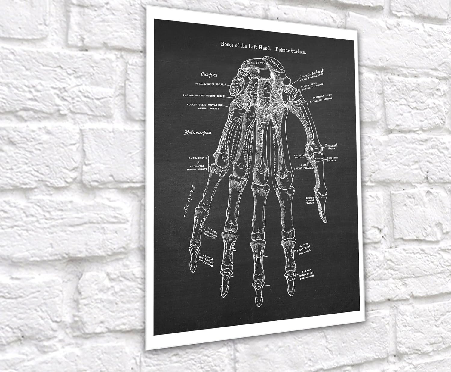 Gnosis Picture Archive Anatomía de huesos de mano médica, juego de 3 impresiones artísticas sin marco, decoración ortopédica de oficina