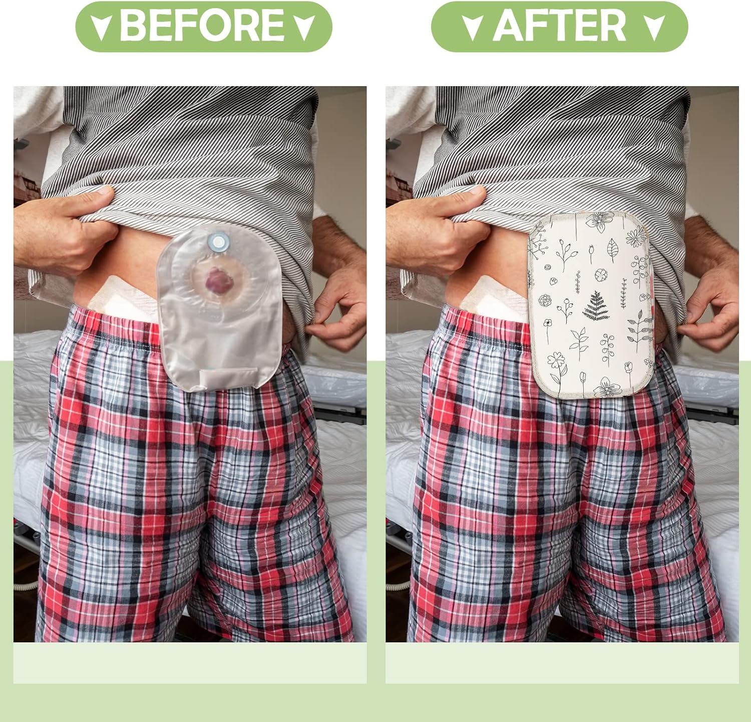 9 fundas para bolsas de ostomía, impermeables, para ducha, ligeras, para colostomía, reutilizables, lavables, con apertura ajustable, suministros de