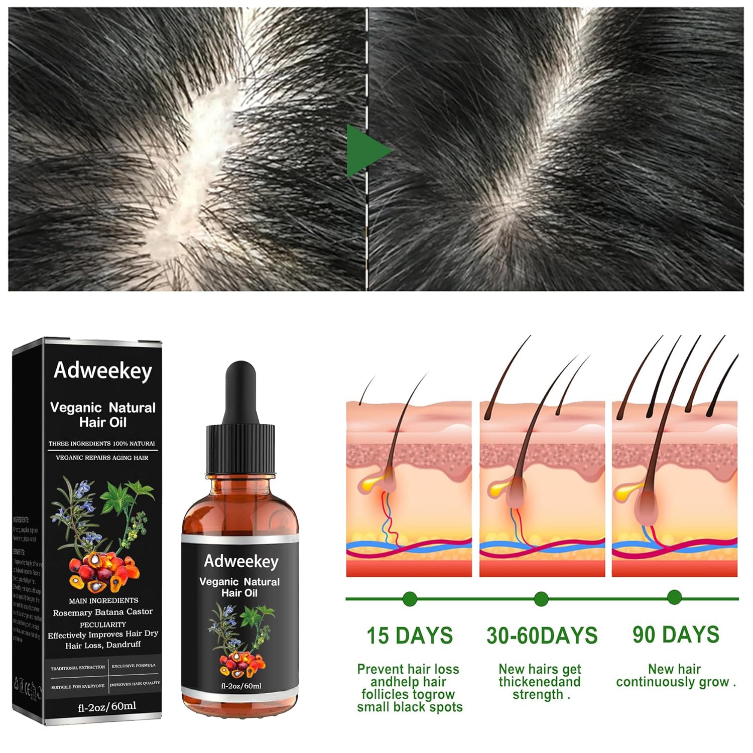 Veganic Aceite orgánico natural de batiana de ricino de romero para cabello saludable, aceite de batana para el crecimiento del cabello, 100%
