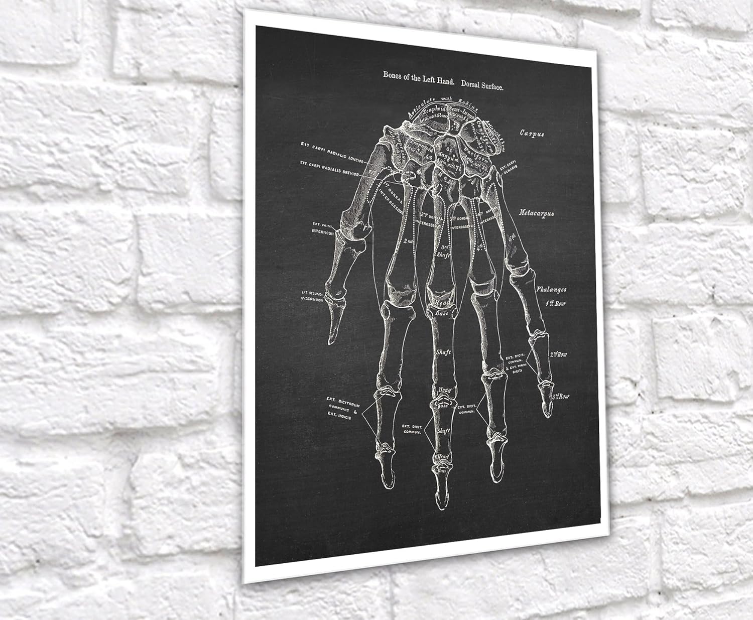 Gnosis Picture Archive Anatomía de huesos de mano médica, juego de 3 impresiones artísticas sin marco, decoración ortopédica de oficina