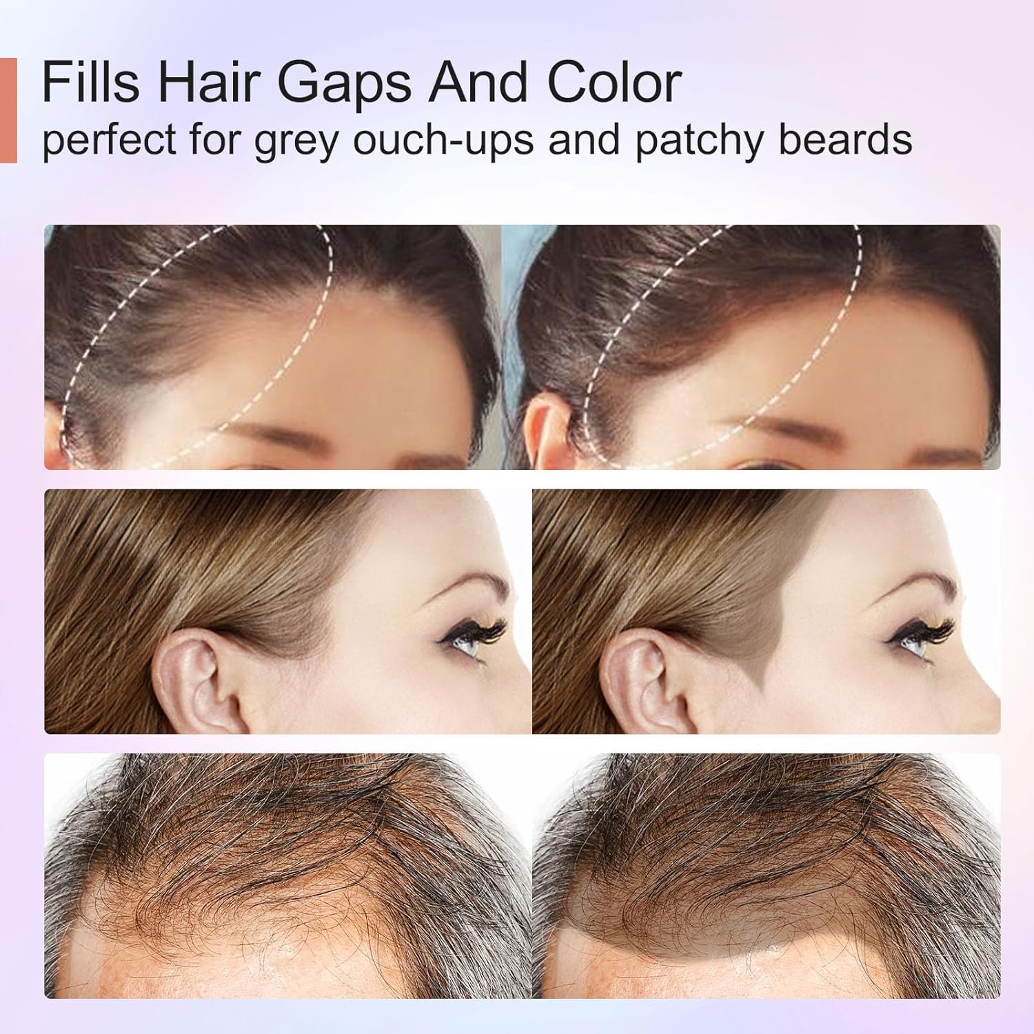 Acomler Polvo de sombra para cubrir instantáneamente la línea del cabello, polvo de cabello para retoque de raíz, marrón oscuro para cabello