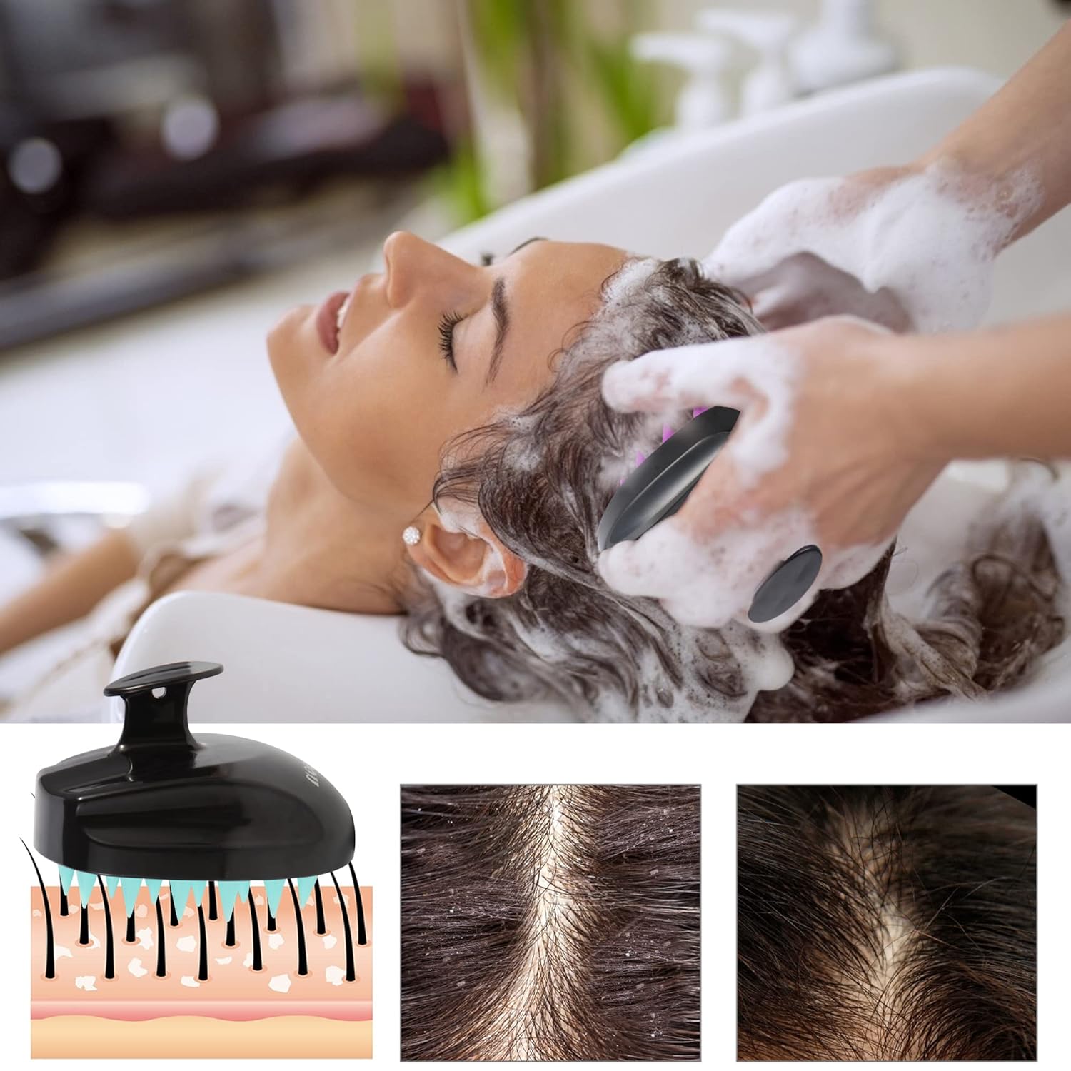Sosoon Cepillo de champú masajeador de cuero cabelludo, exfoliante de silicona suave para hombres, mujeres, niños, crecimiento del cabello, alivio