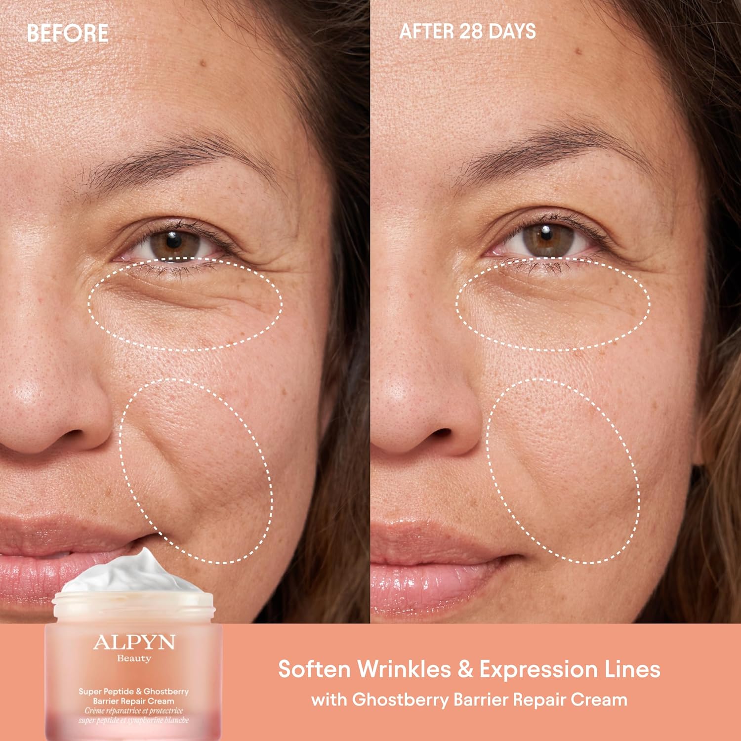 Alpyn Beauty Super Peptide & Ghostberry Hidratante para reparación de eczema, barrera y arrugas  Calma y calma contra el enrojecimiento y la