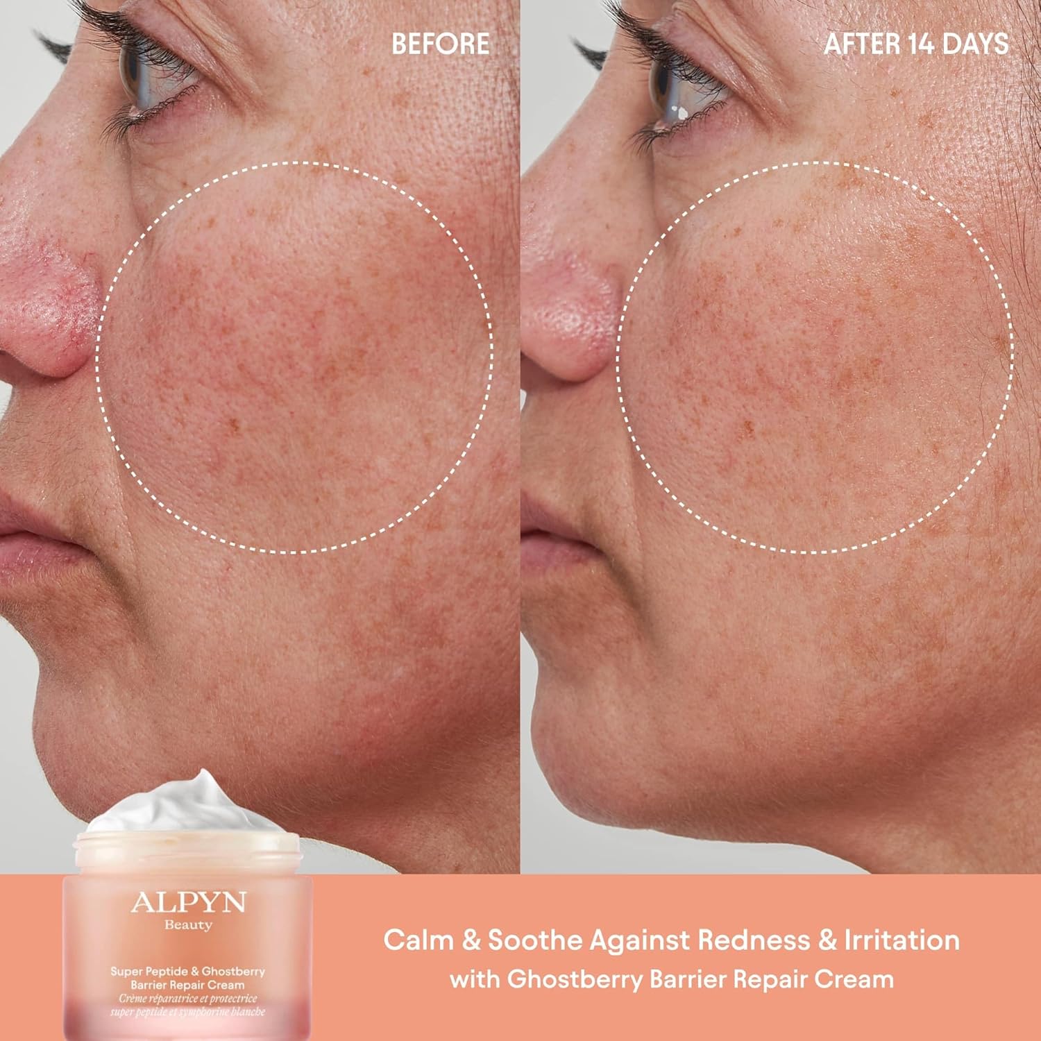 Alpyn Beauty Super Peptide & Ghostberry Hidratante para reparación de eczema, barrera y arrugas  Calma y calma contra el enrojecimiento y la