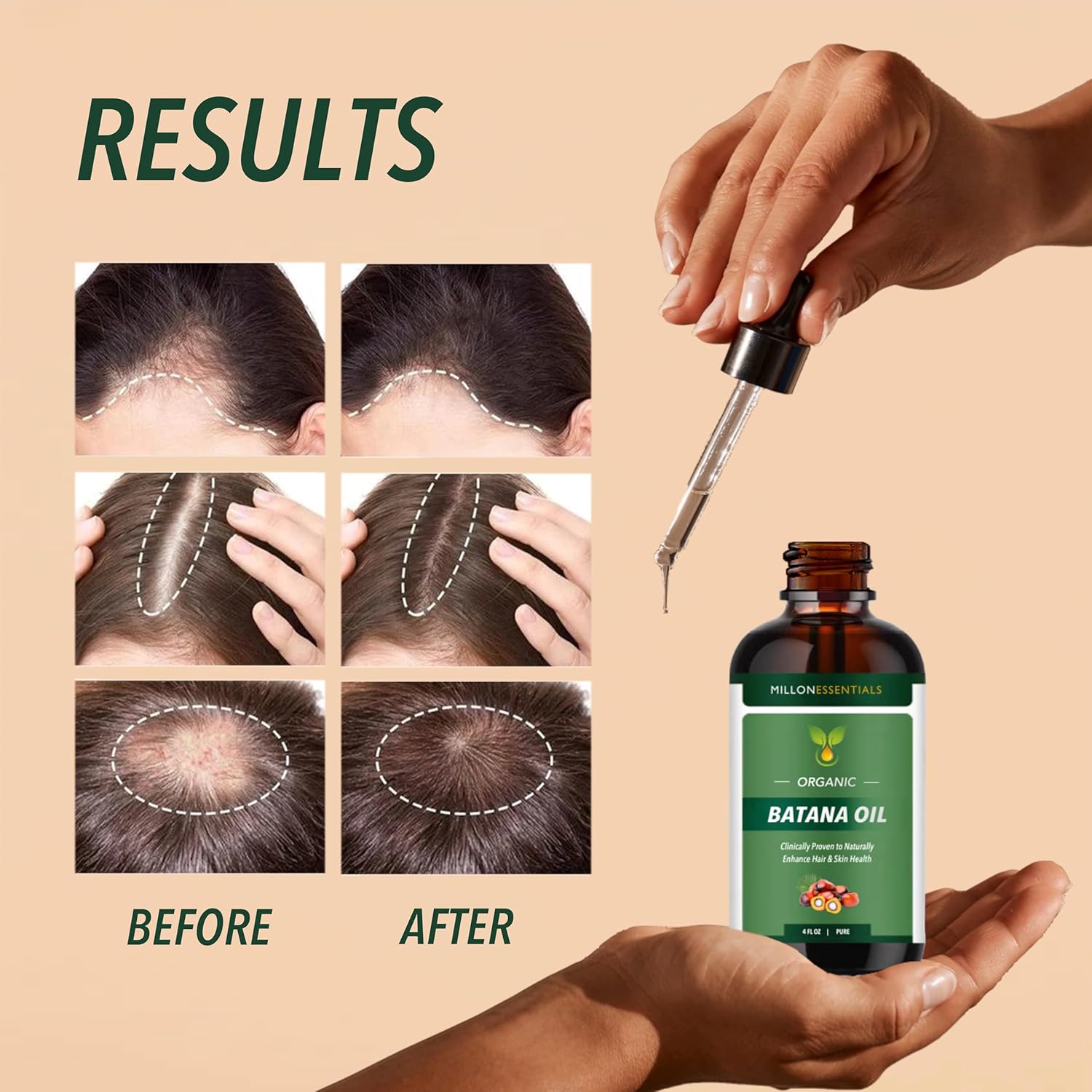 Aceite de batana orgánico puro de 4 onzas para el crecimiento del cabello y el bienestar de la piel, tratamiento nutritivo e hidratante de Honduras,