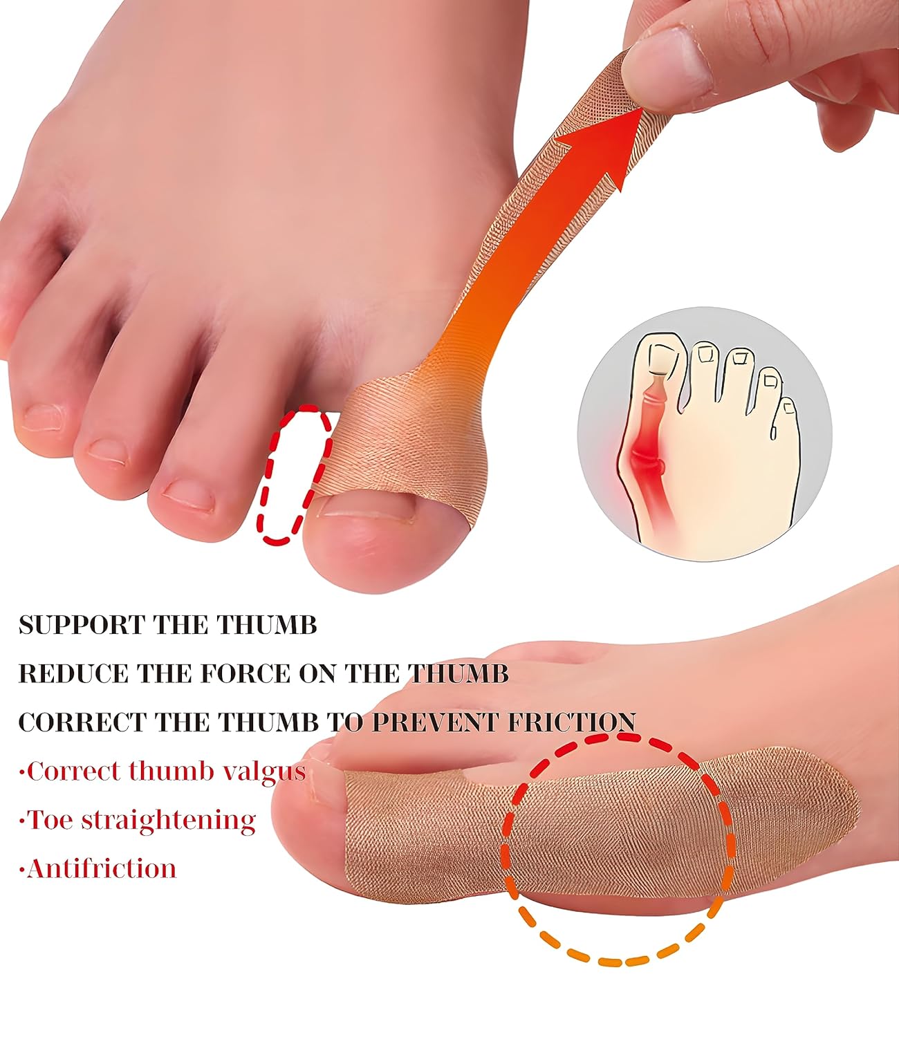 Ortesis de valgo para dedos grandes, el mejor corrector de juanetes, 20 calcomanías autoadhesivas para la cubierta del pulgar, corrector de juanetes