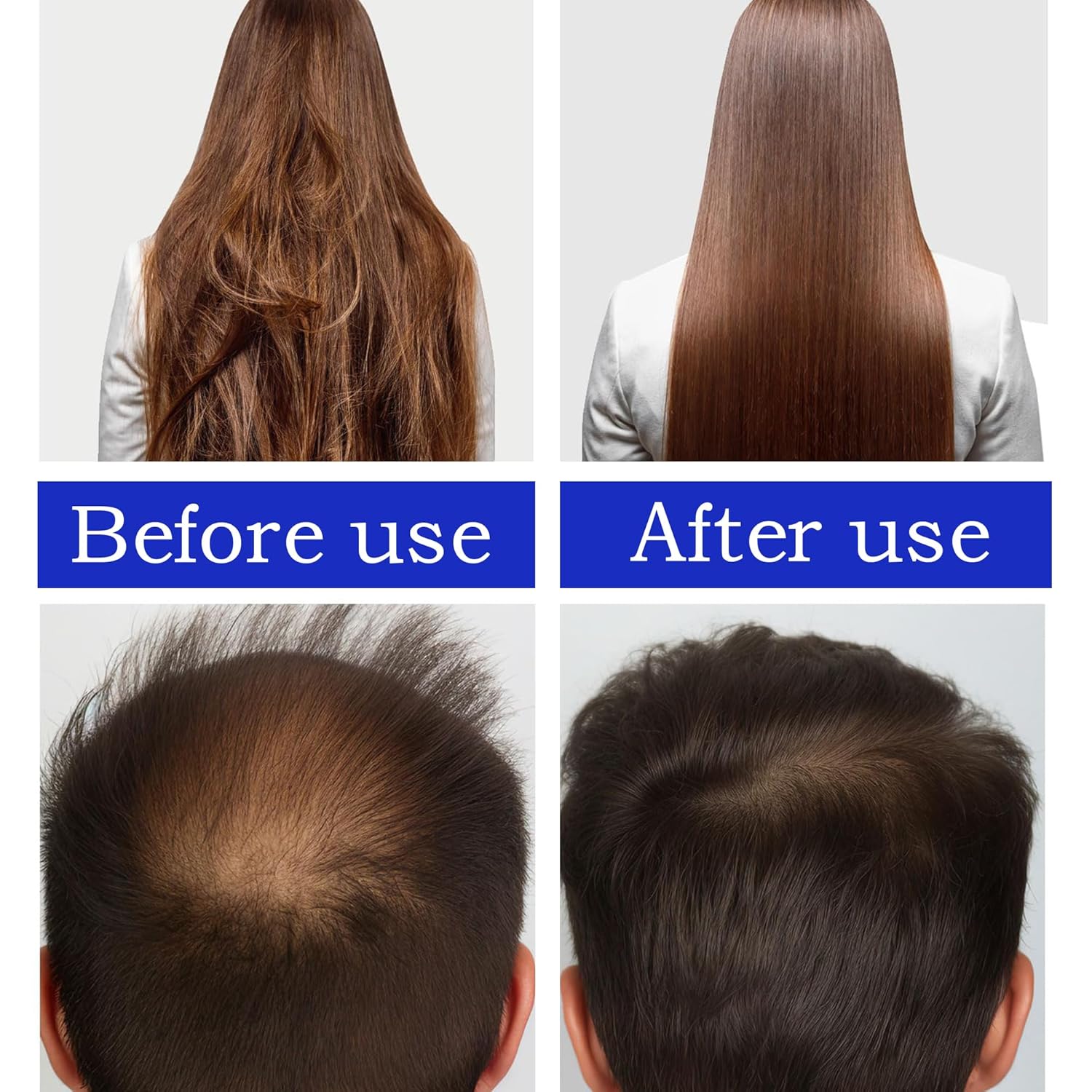 Veganic Aceite orgánico natural de batiana de ricino de romero para cabello saludable, aceite de batana para el crecimiento del cabello, 100%