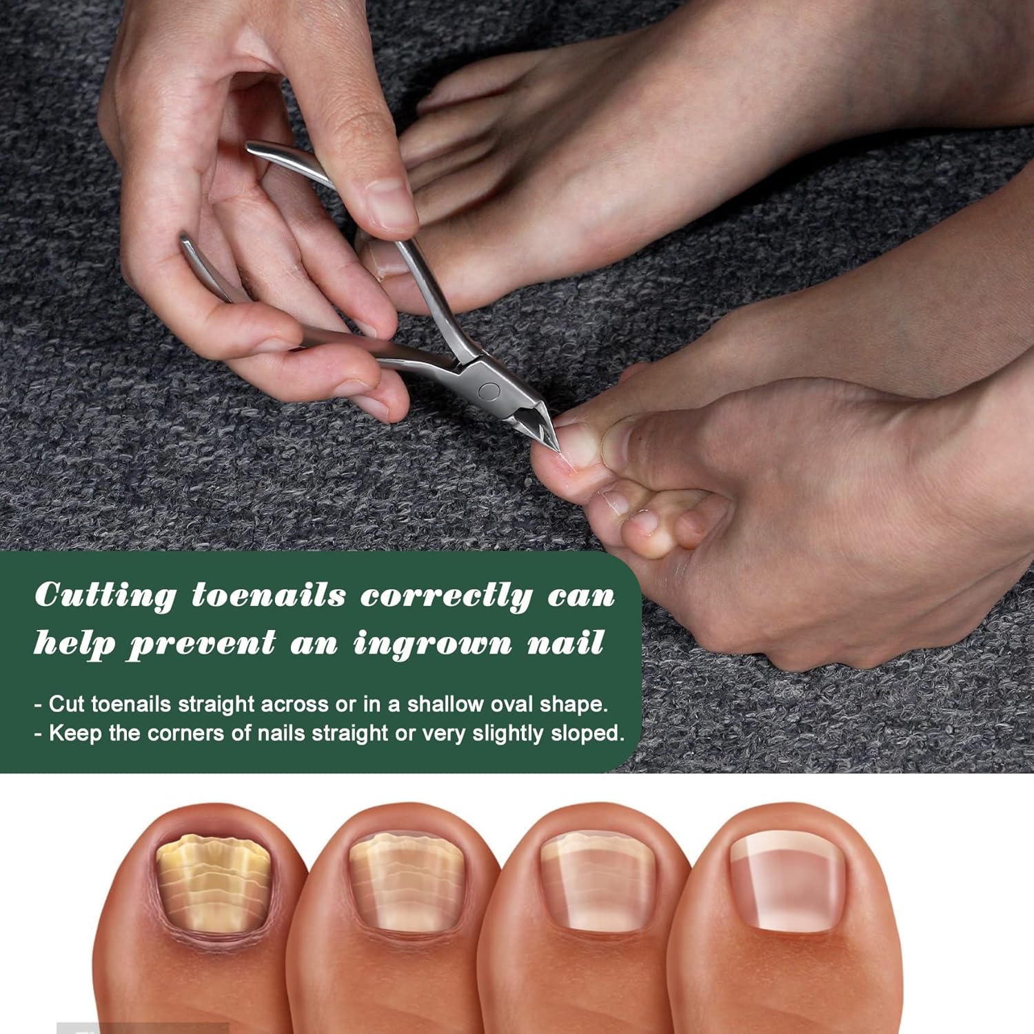 FVION Toenail Clipper Straight Blade, Professional Toe Nail Clipper for Senior, Ingrown Toenail Tool for Thick Ingrown Nails
