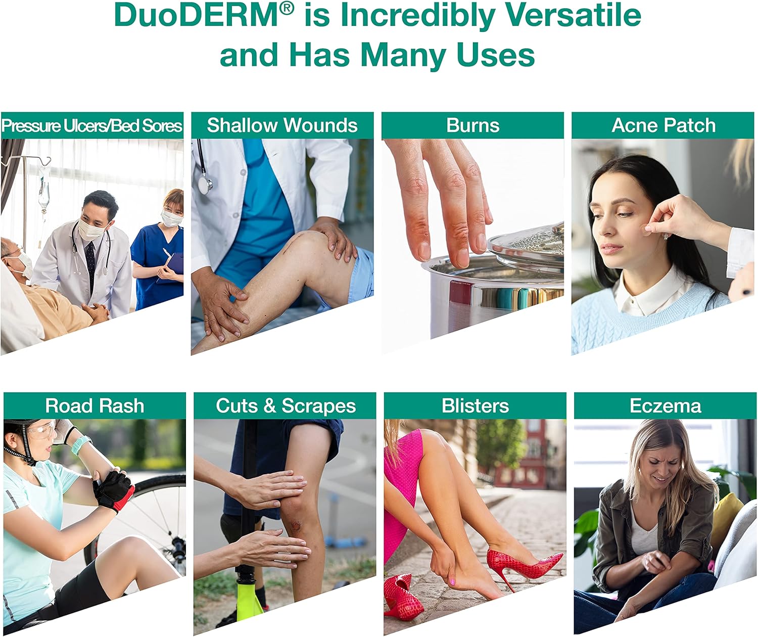 ConvaTec DuoDERM CGF – Apósito estéril hidrocoloide de 6 x 6 pulgadas para uso en heridas parciales y de espesor completo, cuadrado, beige, 187661,