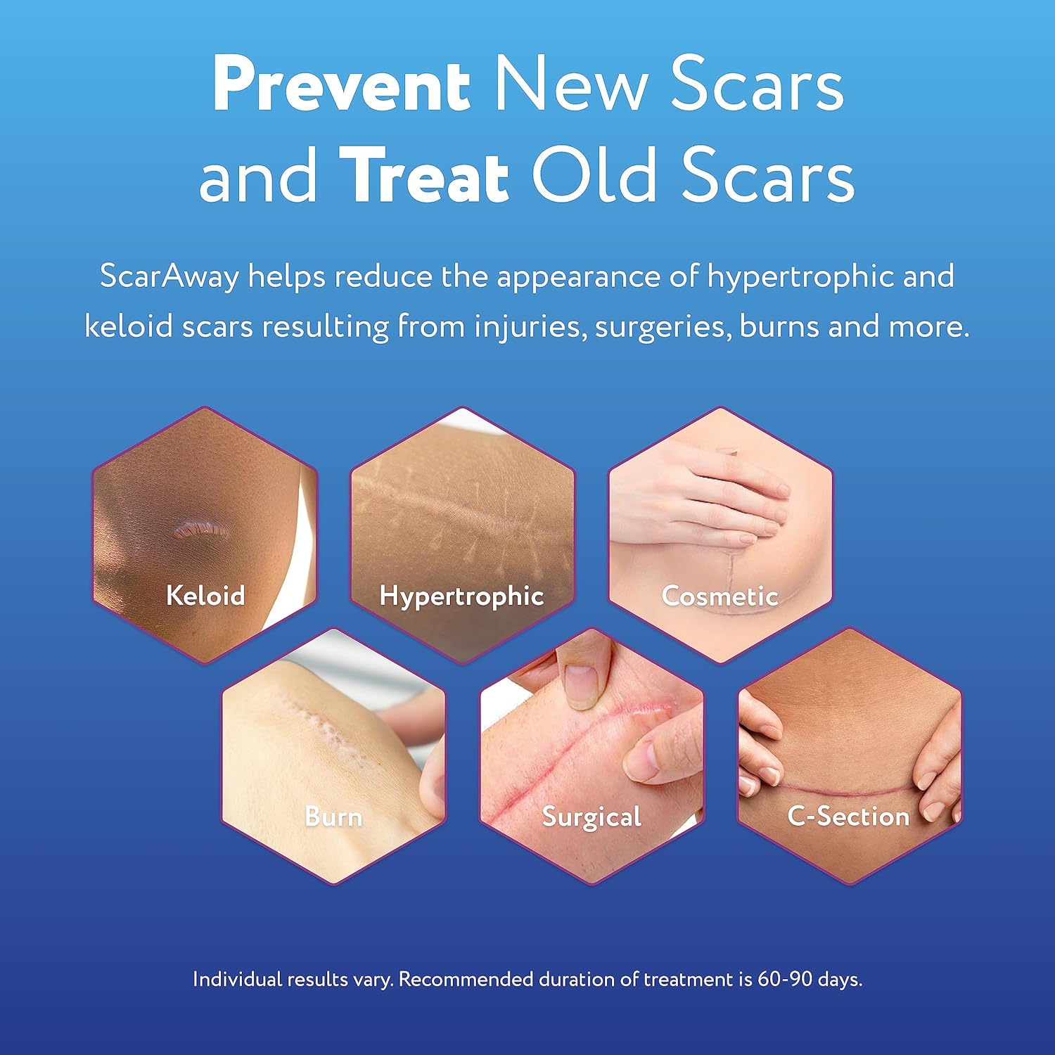 ScarAway Gel de silicona para cicatrices, ayuda a mejorar el tamaño, el color y la textura de las cicatrices hipertróficas y queloides de lesiones,