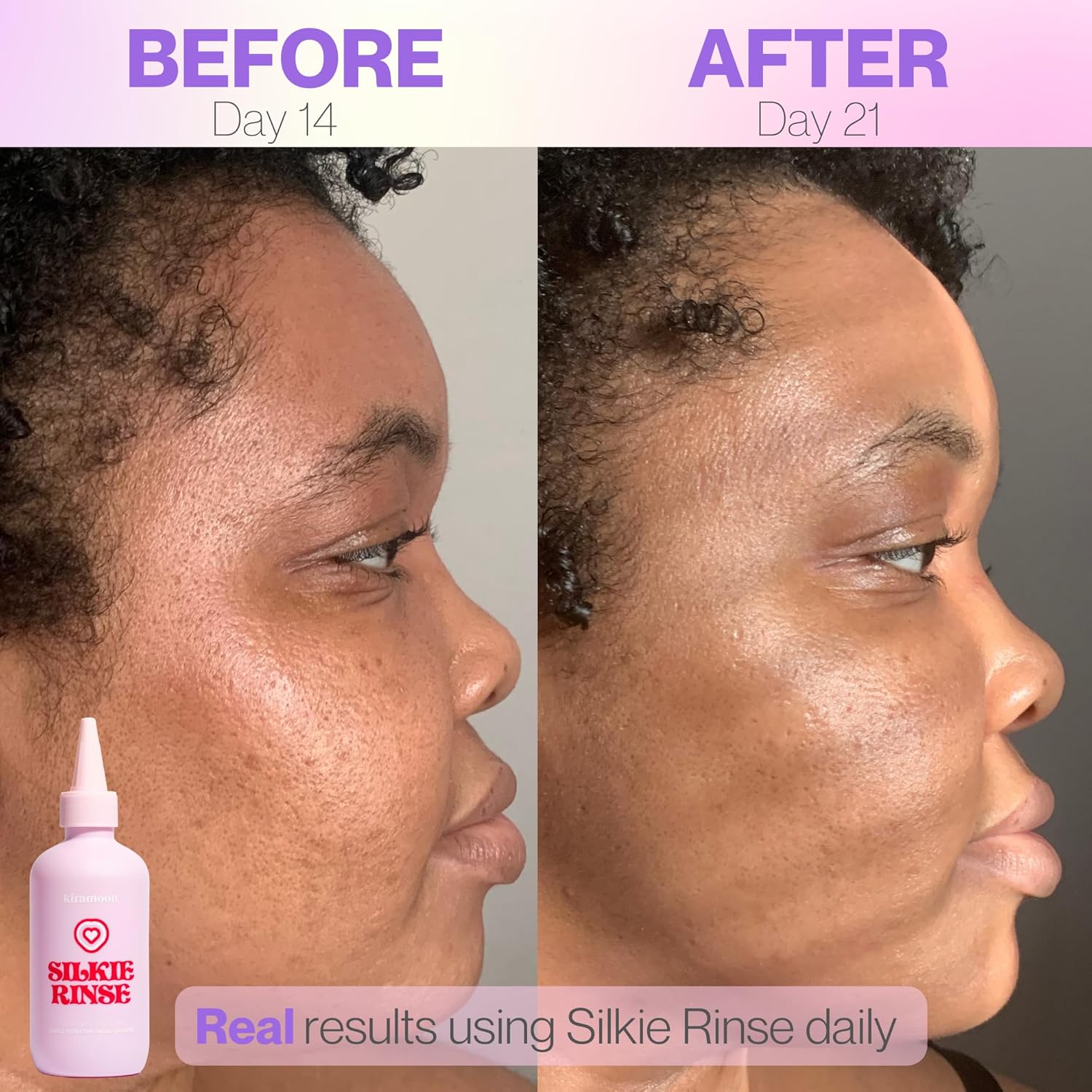 Jabón facial Silkie Rinse Hidratante Suave Limpiador Facial para Piel Seca o Sensible  Desmaquillante Hidratante y Lavado Facial con Ceramidas y