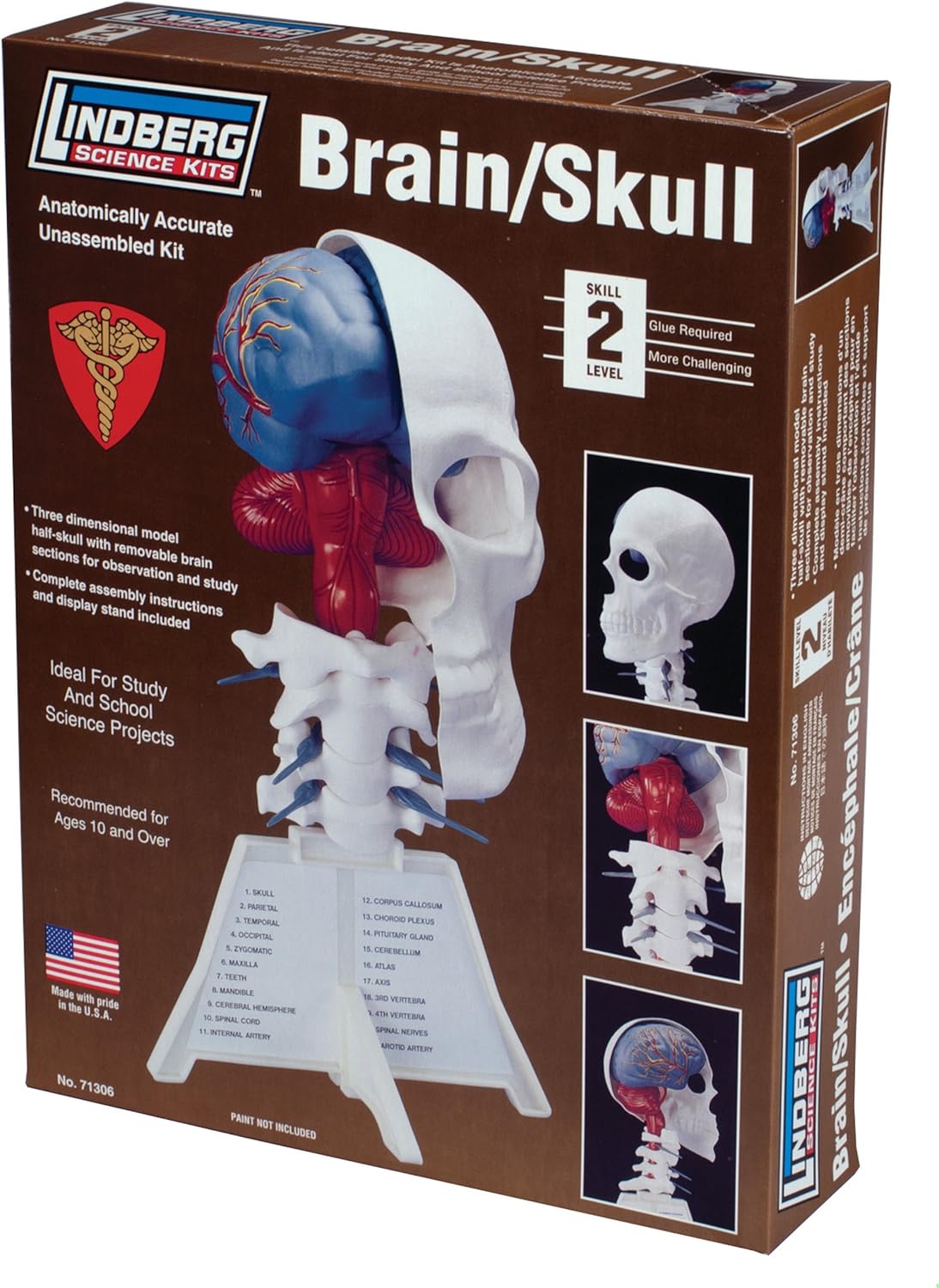 Lindberg Brain and Skull Half