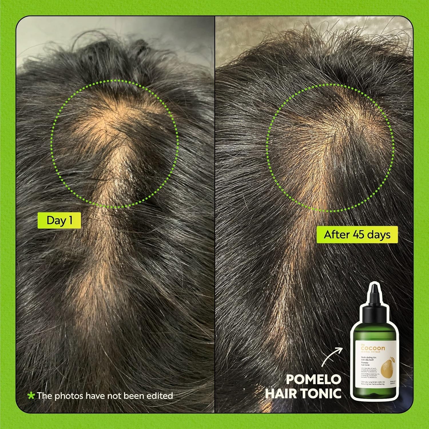 Cocoon Ultimate Hair Repair Set (SAVE 30%) 1x Pomelo Hair Tonic (4.7 fl oz), 1 champú pomelo (16.9 fl oz), 1 acondicionador de pomelo (16.9 fl oz),