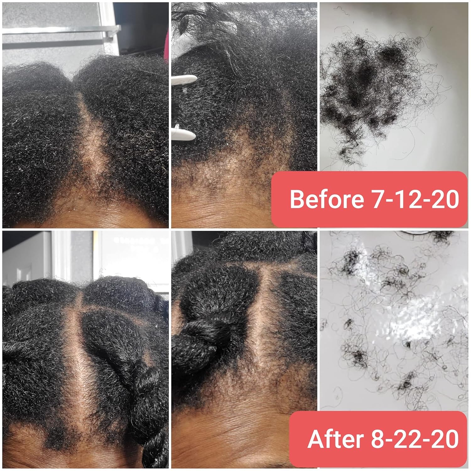 CWHaircare Spray para el cuero cabelludo (el arma secreta) para ayudar a revertir la alopecia y la pérdida general de cabello al promover tasas de