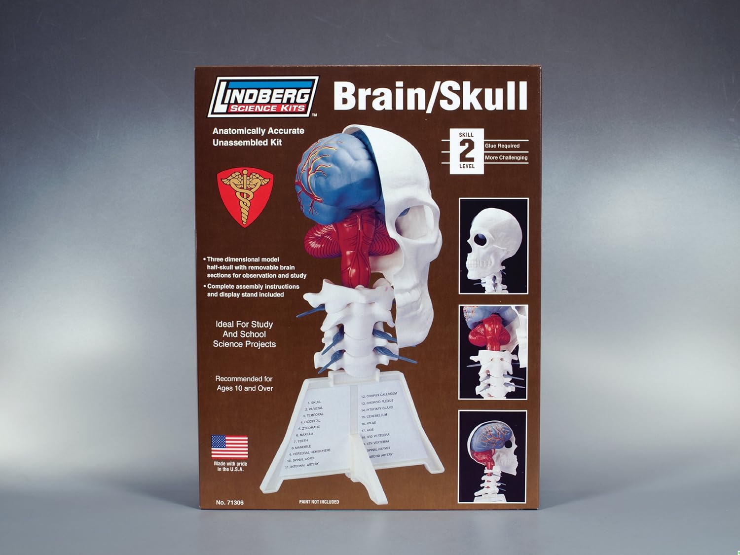 Lindberg Brain and Skull Half