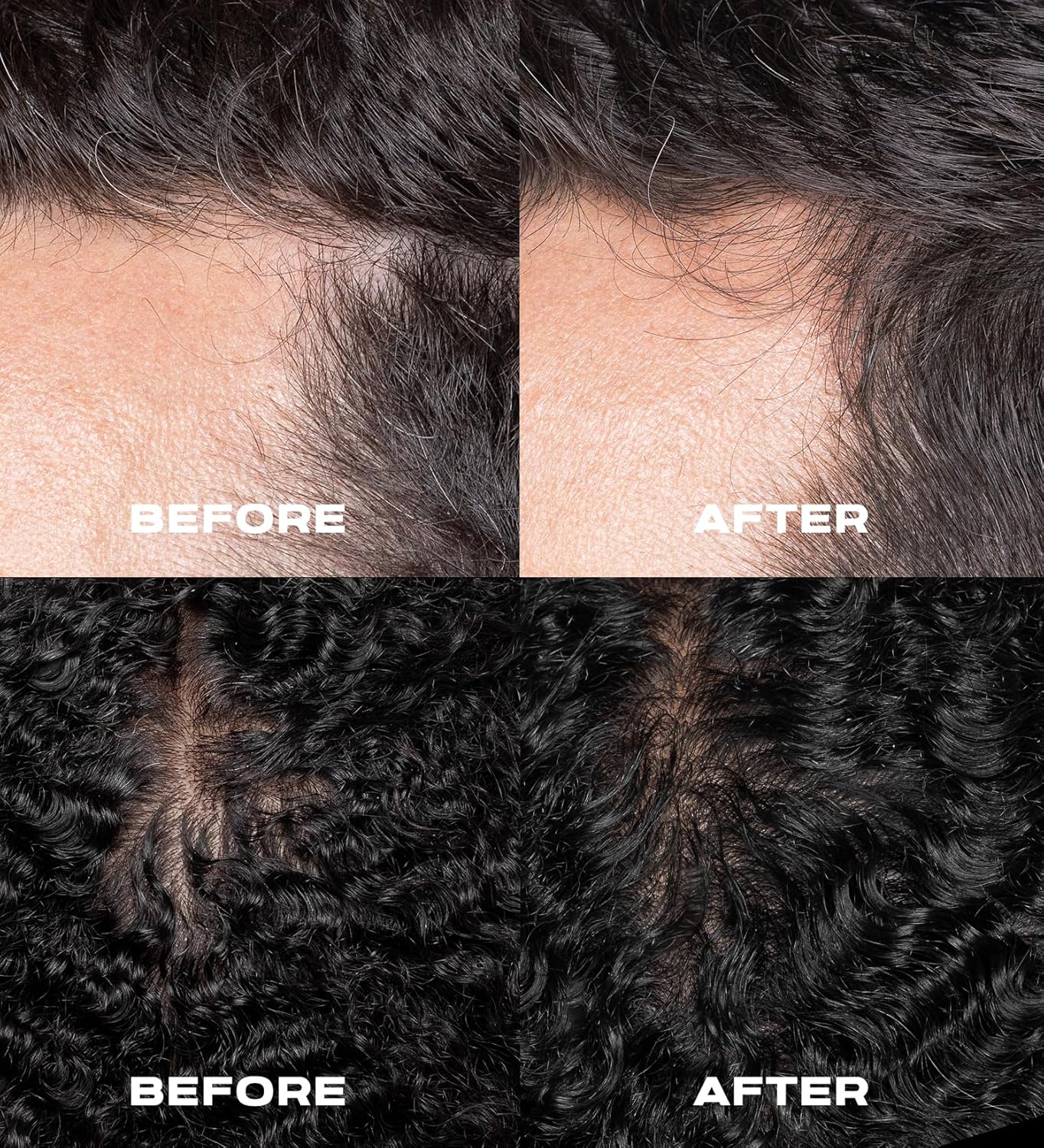 XMONDO Hair A3 Complex Espuma de densidad capilar de alta intensidad  Fórmula vegana con biollagen y amaranto, activos vegetales de acción rápida