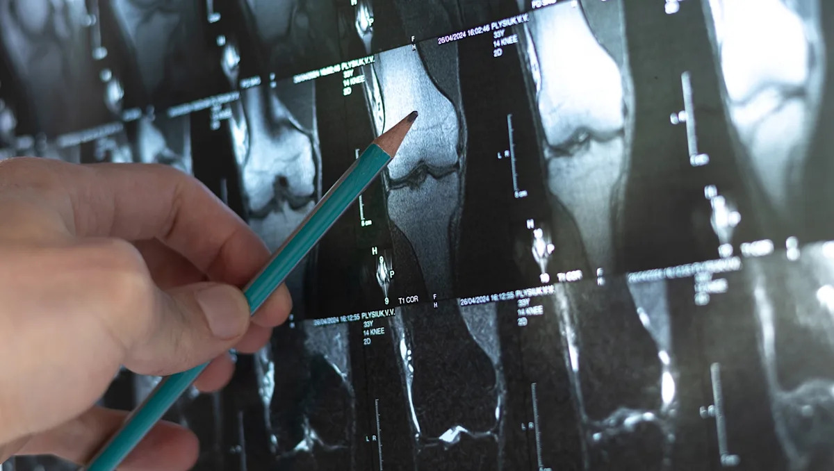 Scientists sound alarm after making unsettling discovery deep in human bones: 'There's a gap in our knowledge' Scientists sound alarm after making unsettling discovery deep in human bones: 'There's a gap in our knowledge'