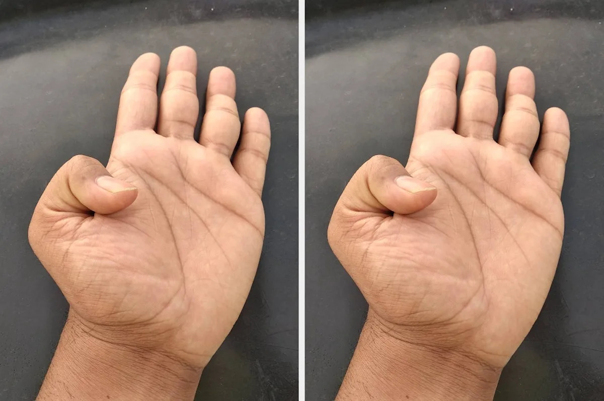 This 2-Second Thumb Test Could Indicate If You’re At Risk For A Heart Problem — Here’s How To Do It At Home This 2-Second Thumb Test Could Indicate If You’re At Risk For A Heart Problem — Here’s How To Do It At Home